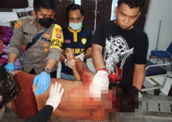 Korban D (30) warga Kelurahan Tampang Tumbang Anjir saat akan divisum di UPT RSUD Kuala Kurun, Kamis (14/4/2022). (IST)