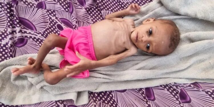 Anak lelaki usia satu tahun yang kekurangan gizi Jiad Muhammad Jalal terbaring di matras di sebuah kamp pengungsi di Hajja, Yaman, Jumat (15/4/2022). Foto diambil tanggal 15 April 2022. (MASAPNEWS/ANT/REUTERS)